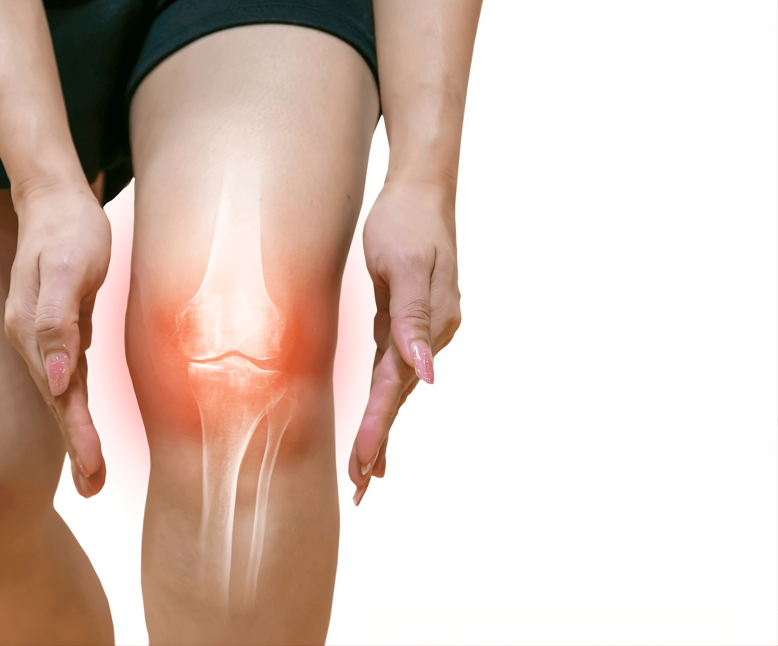 Hỗ trợ điều trị thoái hóa khớp, đau khớp với FLEX G.C.M